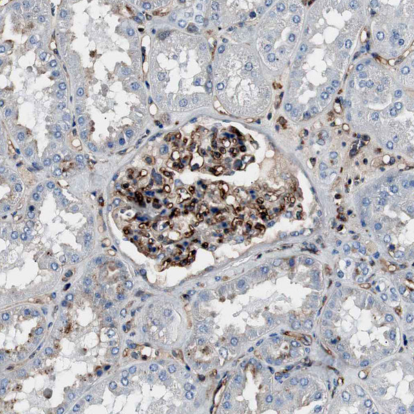 Beta-2 Microglobulin (Clone B2M/1118) - Teomics