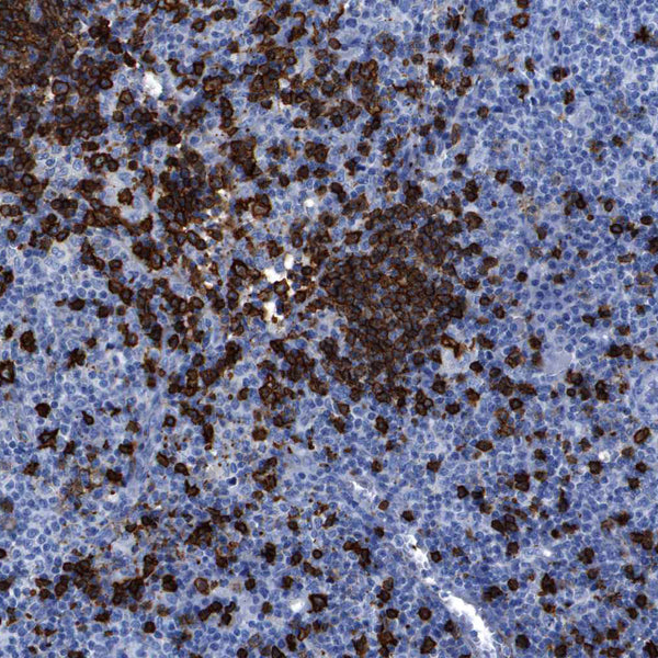 CD20 / MS4A1 (Clone L26 & IGEL/773) - Teomics
