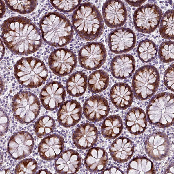 CD30, Ki-1 Antigen (Clone Ber-H2) - Teomics