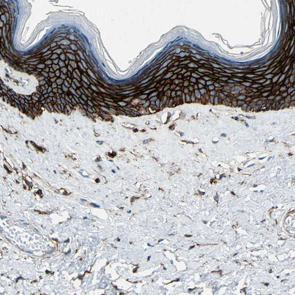 CD44 / HCAM Std. (Clone HCAM/918) - Teomics