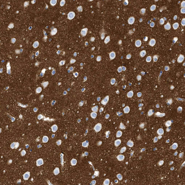 CD56 / NCAM1 / NKH1 (Clone NKH1/784) - Teomics