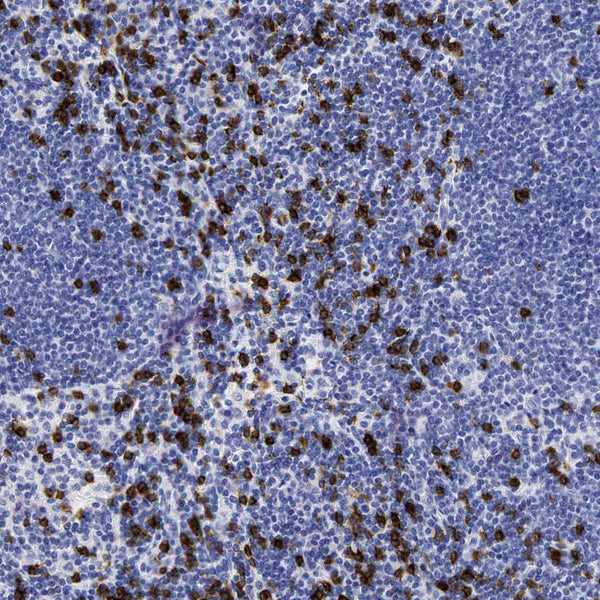 CD8A (Rabbit Polyclonal) - Teomics