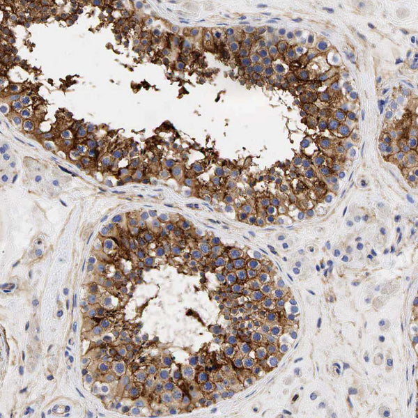 MIC2 Gene Protein, CD99 (Clone HO36-1.1) - Teomics