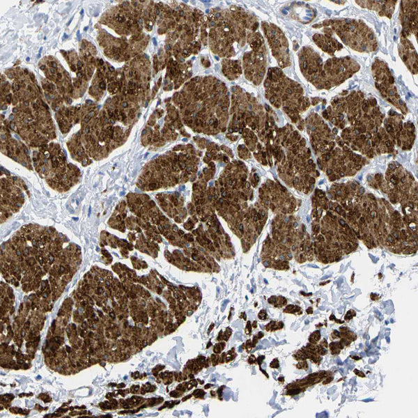 Calponin-1 (Clone CALP) - Teomics