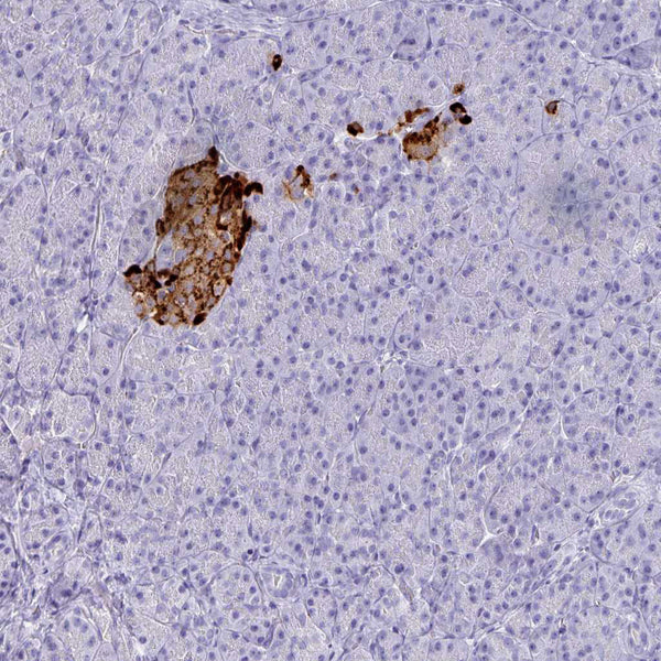 Chromogranin A / CHGA (Clone CHGA/765) - Teomics