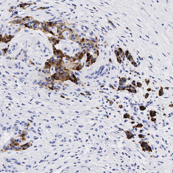 Chromogranin A / CHGA (Clone CHGA/777) - Teomics