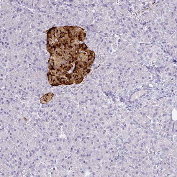 Chromogranin A / CHGA (Clone CHGA/798) - Teomics