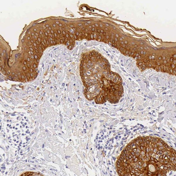 Cytokeratin 17 (KRT17) (Clone KRT17/778) - Teomics