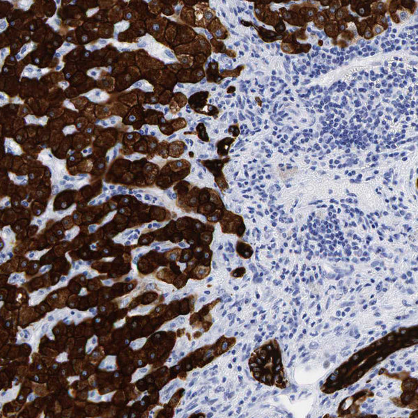 Cytokeratin 18 (KRT18) (Clone KRT18/835) - Teomics