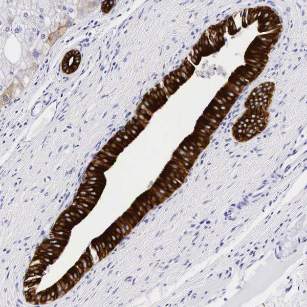 Cytokeratin 18 (KRT18) (Clone KRT18/836) - Teomics