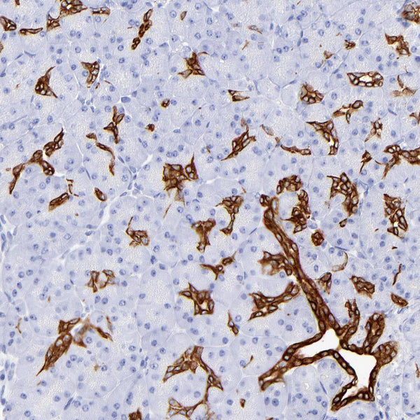 Cytokeratin 19 (KRT19) (Clone A53-B/A2.26) - Teomics