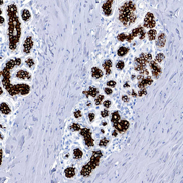 Cytokeratin 7 (Clone K72.7) - Teomics