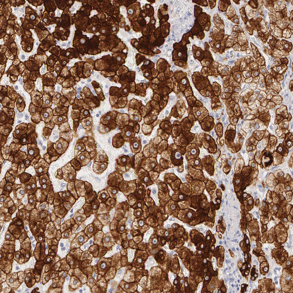 Cytokeratin 8 (KRT8) (Clone KRT8/818) - Teomics