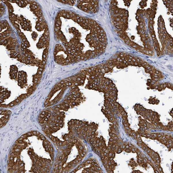 Cytokeratin 8 (KRT8) (Clone 34BH11) - Teomics