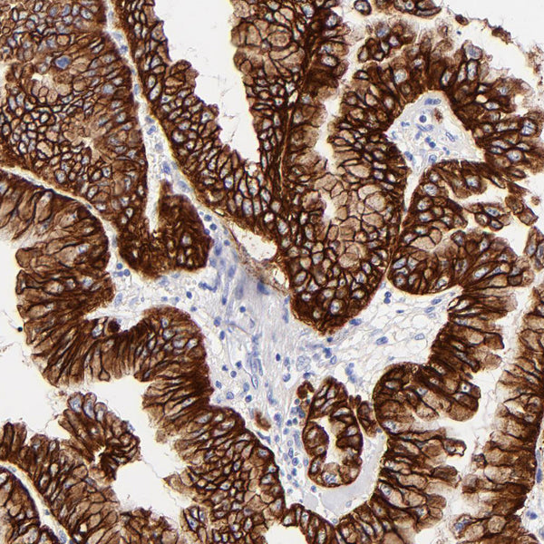 Cytokeratin, Acidic (Type I or LMW) (Clone KRTL) - Teomics