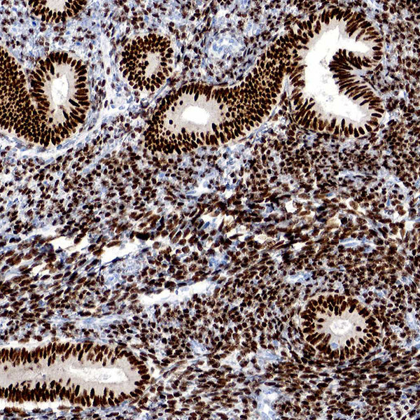 Estrogen Receptor (Clone 1D5) - Teomics