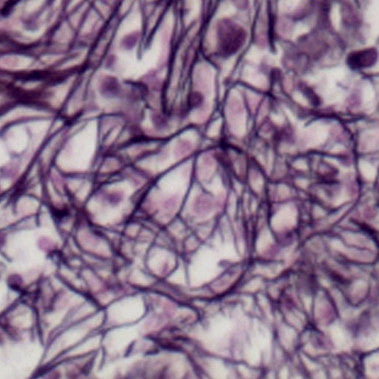 Reticulum Stain Kit (Modified Gomori's) - Teomics