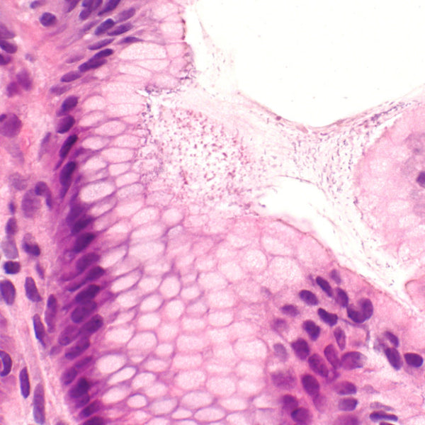 Helicobacter Pylori (Control Slides) - Teomics