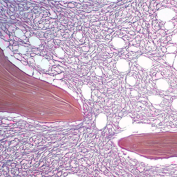 Reticulum Stain Kit (Modified Gomori's) - Teomics
