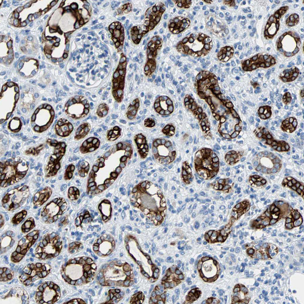 Cytokeratin 7 (Clone KRT7/760) - Teomics