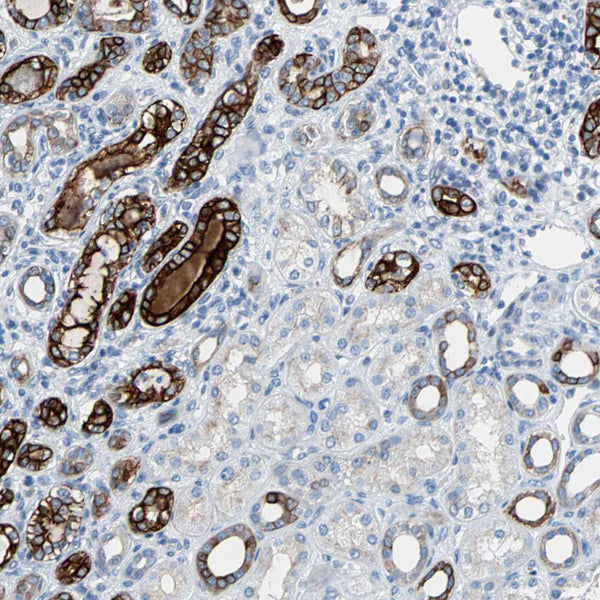 Cytokeratin 7 (Clone OV-TL12/30) - Teomics