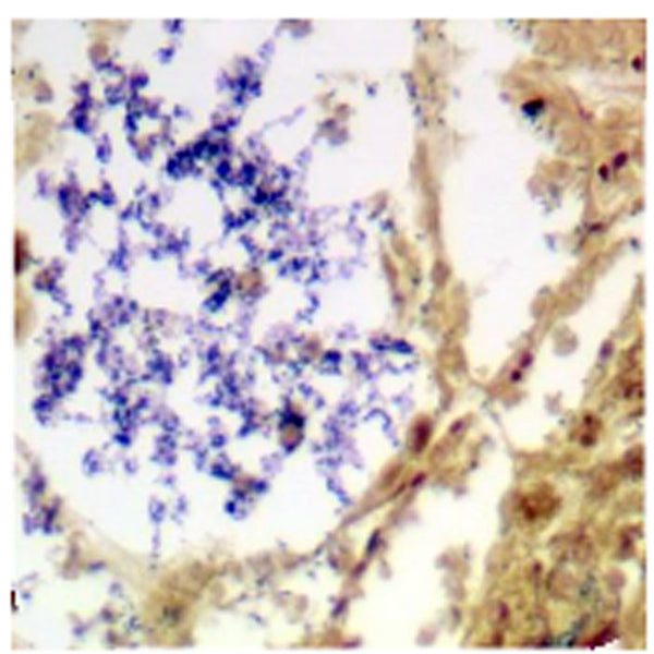 Gram Stain Kit - Teomics