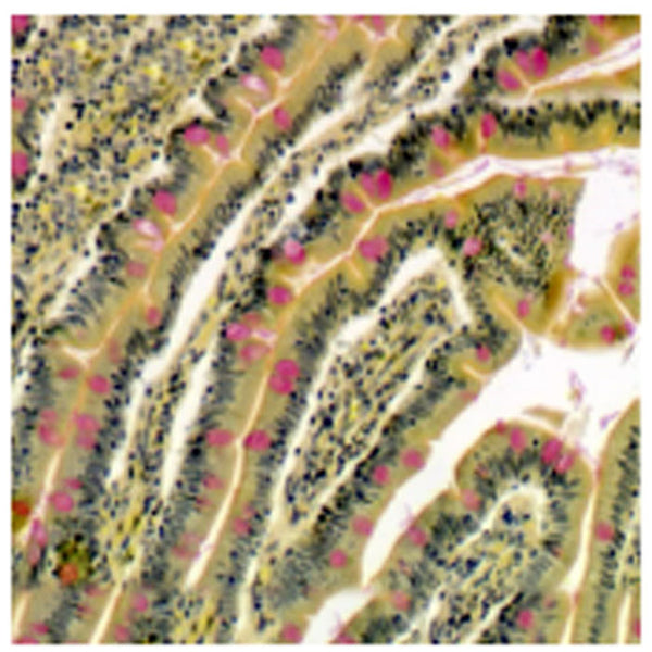 Mucicarmine Stain Kit (Modified Southgate's) - Teomics