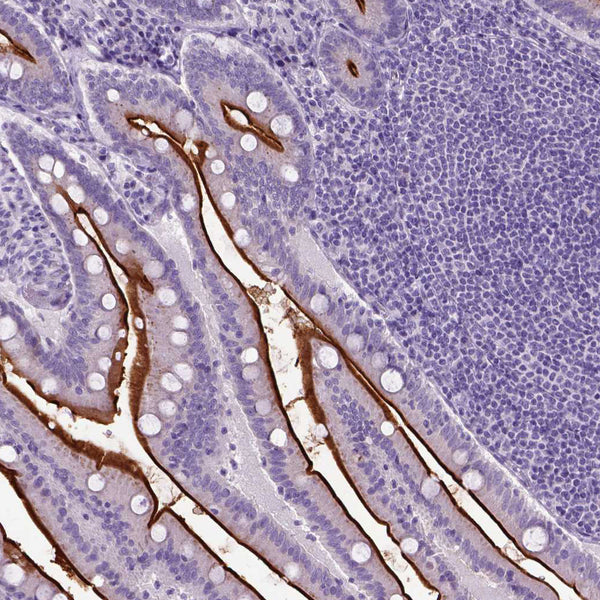 CD10 / Neprilysin / CALLA (Clone 56C6) - Teomics