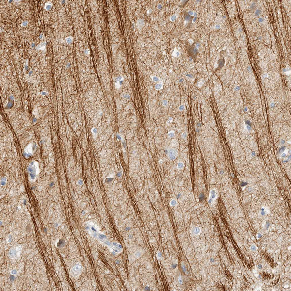 Neurofilament (Clone 2F11) - Teomics