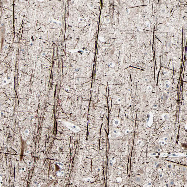 Neurofilament (NF-H) (Clone NF421) - Teomics