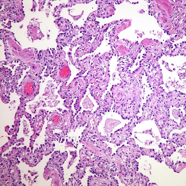 Pneumocystis (Control Slides) - Teomics