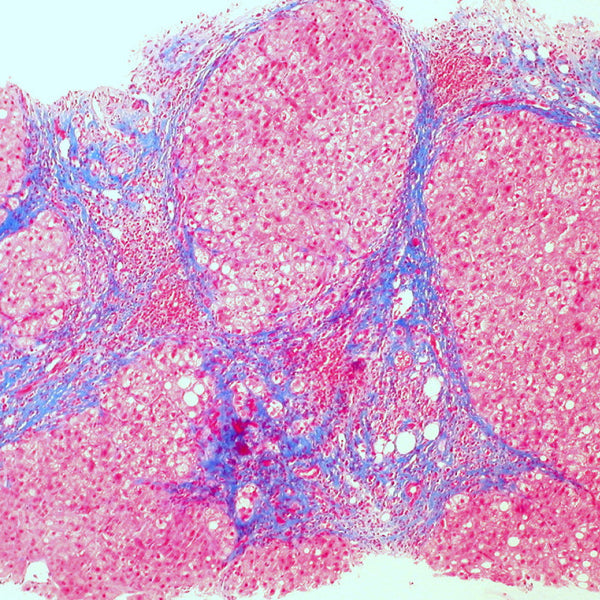 Trichrome - Liver (Control Slides) - Teomics