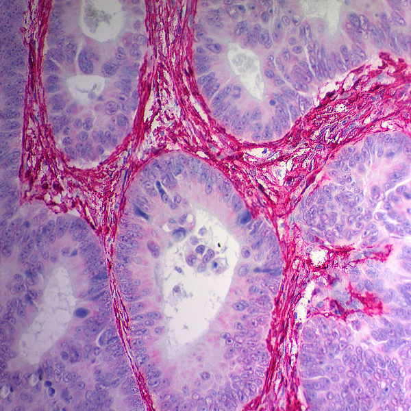 Actin, Smooth Muscle (Clone 1A4) - Teomics